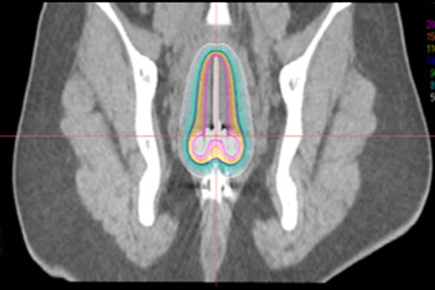 A First of its Kind Procedure Performed by American Hospital in Dubai A First of its Kind Procedure Performed by American Hospital in Dubai
